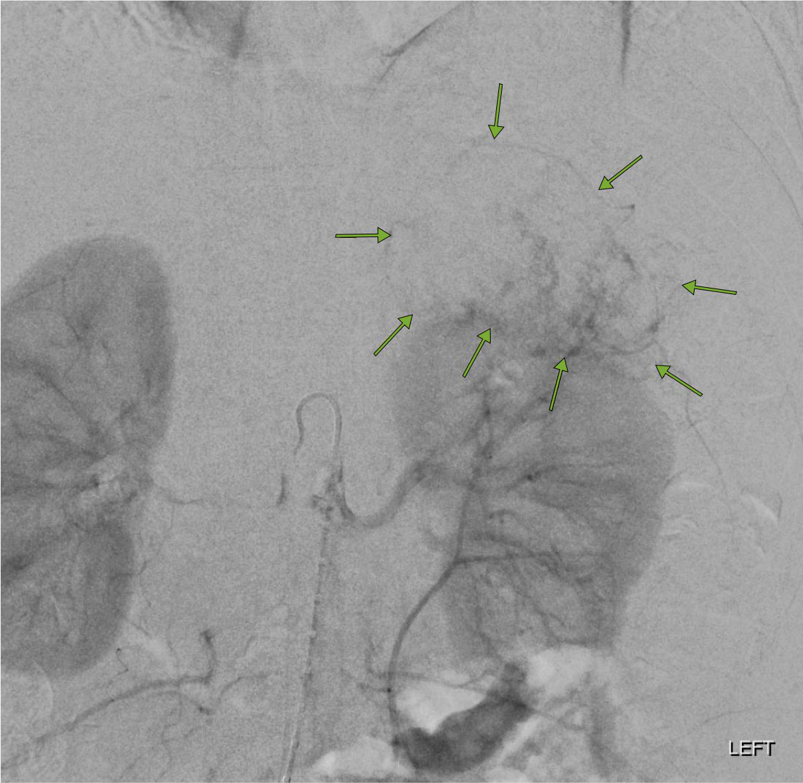radiology imaging of lungs