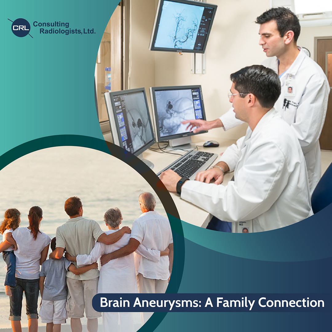 Brain Aneurysm: A Family Connection