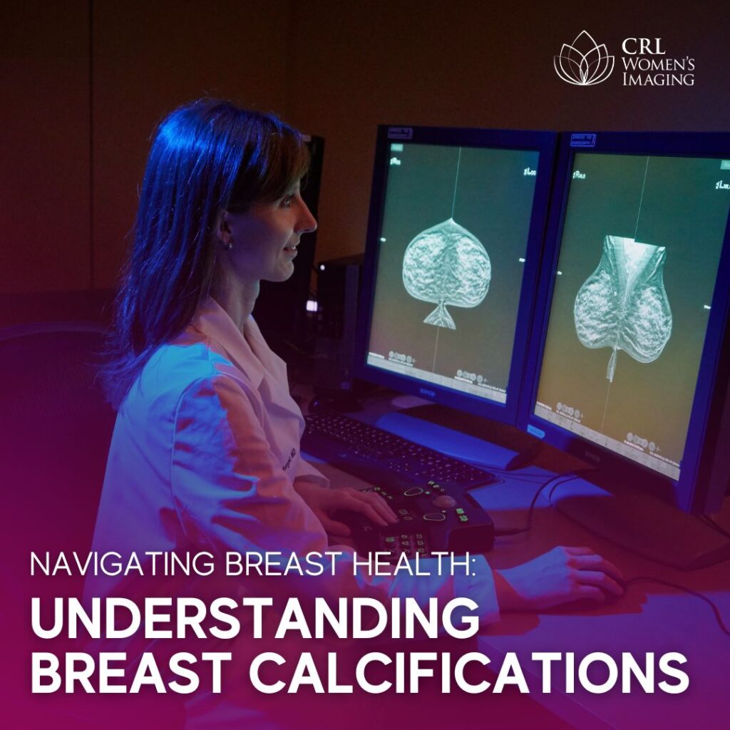 Navigating Breast Health: Understanding Breast Calcifications ...